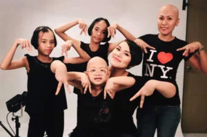 Alopecia areata awareness
