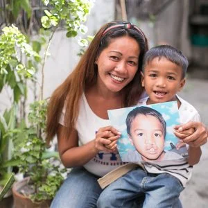 globe telecom - smile train - cleft lip and palate - patient