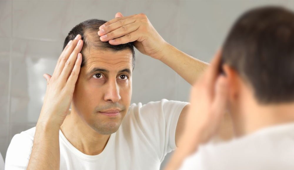 Reasons for Hair Loss in Men and Women